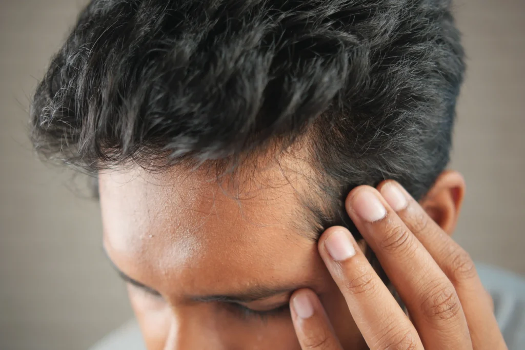 Close-up of a man's temple with his head tilted down and hand raised to his hairline, showing sparse, fine hairs along a receding temple typical of androgenetic alopecia.